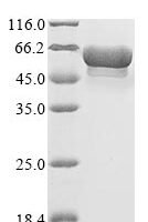 Helicobacter pylori 60 kDa chaperonin (groL), partial Recombinant Protein - BioCrest Sci