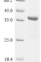 Human respiratory syncytial virus A Major surface glycoprotein G (G), partial,Biotinylated Recombinant Protein - BioCrest Sci