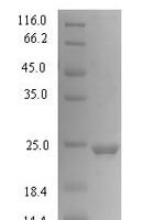 Human Growth-regulated alpha protein (CXCL1) Recombinant Protein, N-His-SUMO - BioCrest Sci