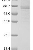 rat Receptor-interacting serine/threonine-protein kinase 3 (Ripk3) Recombinant Protein - BioCrest Sci
