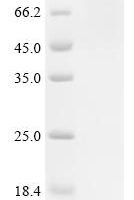 Potato leafroll virus Protein P1-P2, partial Recombinant Protein - BioCrest Sci