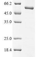 Human Kynureninase (KYNU) Recombinant Protein - BioCrest Sci