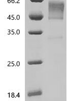 Dog Interleukin-13 (IL13) Recombinant Protein, C-hFc1 - BioCrest Sci