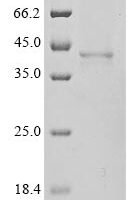 Human ADP-ribose glycohydrolase MACROD1 (MACROD1) Recombinant Protein - BioCrest Sci