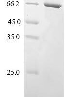 Human Fc receptor-like protein 3 (FCRL3), partial Recombinant Protein - BioCrest Sci