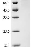 Human Protein mono-ADP-ribosyltransferase PARP3 (PARP3) Recombinant Protein - BioCrest Sci