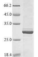 Human Blood group Rh (D) polypeptide (RHD), partial Recombinant Protein, N-GST - BioCrest Sci