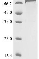 Human Semaphorin-3B (SEMA3B) Recombinant Protein, N-His - BioCrest Sci