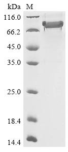 Human Semaphorin-3B (SEMA3B) Recombinant Protein, N-His, Homo sapiens (Human), E.coli, N-terminal 6xHis-tagged, 85.0 kDa, purity >≥ 85% as determined by SDS-PAGE.