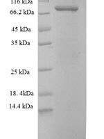Human Stress-induced-phosphoprotein 1 (STIP1) Recombinant Protein - BioCrest Sci