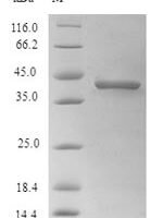Zaire ebolavirus Pre-small/secreted glycoprotein (GP) Recombinant Protein, N-His, aa 33–364, strain Eckron-76, E.coli - BioCrest Sci