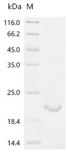 Rat Muellerian-inhibiting factor (Amh) Recombinant Protein, Rattus norvegicus (Rat), E.coli, C-terminal 6xHis-tagged, 18.6 kDa, purity >≥ 85% as determined by SDS-PAGE.