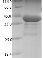 Human Serine/threonine-protein phosphatase PP1-beta catalytic subunit (PPP1CB) Recombinant Protein - BioCrest Sci