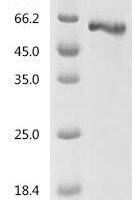 Human Fibrinogen beta chain (FGB) Recombinant Protein, C-His - BioCrest Sci