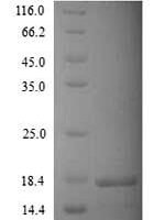 Human Potassium channel subfamily K member 2 (KCNK2), partial Recombinant Protein - BioCrest Sci