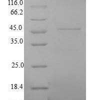 Human Myosin light chain 3 (MYL3) Recombinant Protein - BioCrest Sci