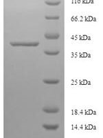 Human La-related protein 1B (LARP1B) Recombinant Protein - BioCrest Sci