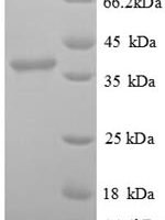 Human Signal recognition particle 14 kDa protein (SRP14), partial Recombinant Protein - BioCrest Sci