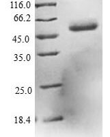 Human L-xylulose reductase (DCXR) Recombinant Protein - BioCrest Sci