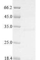 Human Bone morphogenetic protein 3 (BMP3) Recombinant Protein, N-10His/C-Myc - BioCrest Sci