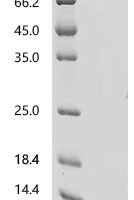 Mouse Guanylate cyclase activator 2B (Guca2b) Recombinant Protein, C-His - BioCrest Sci