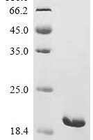 Pasteurella multocida Large ribosomal subunit protein bL25 (rplY) Recombinant Protein - BioCrest Sci