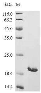 Pasteurella multocida Large ribosomal subunit protein bL25 (rplY) Recombinant Protein, E.coli, C-terminal 6xHis-tagged, 17.5 kDa, purity >≥ 95% as determined by SDS-PAGE.