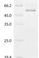 Saponaria officinalis Ribosome-inactivating protein saporin-6 (SAP6) & Streptococcus sp. group G Immunoglobulin G-binding protein G (spg) Recombinant Protein - BioCrest Sci
