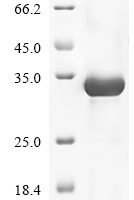 Human Anosmin-1 (KAL1), partial Recombinant Protein - BioCrest Sci