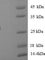 Mouse C-X-C motif chemokine 5 (Cxcl5), partial Recombinant Protein - BioCrest Sci
