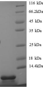 Mouse C-X-C motif chemokine 5 (Cxcl5), partial Recombinant Protein, Mus musculus (Mouse), E.coli, N-terminal 6xHis-tagged, 11.8 kDa, purity >≥ 90% as determined by SDS-PAGE.