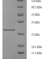 Human Inhibin beta A chain (INHBA) Recombinant Protein, N-His-SUMO - BioCrest Sci