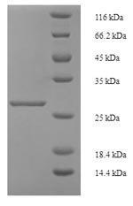 Human Inhibin beta A chain (INHBA) Recombinant Protein, N-His-SUMO, Homo sapiens (Human), E.coli, N-terminal 6xHis-SUMO-tagged, 29.0 kDa, purity >≥ 90% as determined by SDS-PAGE.