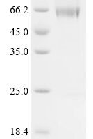 Mouse Z-DNA-binding protein 1 (Zbp1) Recombinant Protein, C-His-Flag - BioCrest Sci