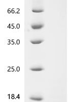 Dog Interleukin-13 (IL13) Recombinant Protein, C-10His - BioCrest Sci