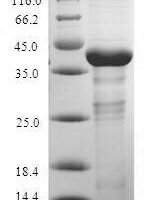 Rabbit Interleukin 17A (IL17A), partial Recombinant Protein, N-GST - BioCrest Sci