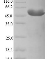 Human Centromere protein K (CENPK) Recombinant Protein - BioCrest Sci