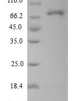 Human L-dopachrome tautomerase (DCT),Partial Recombinant Protein - BioCrest Sci