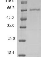 Human Programmed cell death protein 2-like (PDCD2L) Recombinant Protein - BioCrest Sci