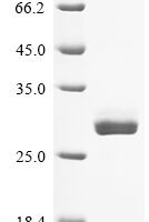Human cytomegalovirus Enhanced green fluorescent protein (egfp) Recombinant Protein, C-His - BioCrest Sci