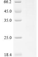Human Diacylglycerol kinase alpha (DGKA) Recombinant Protein - BioCrest Sci