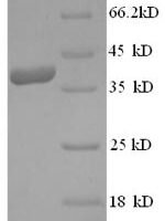 Human Ly6/PLAUR domain-containing protein 6 (LYPD6) Recombinant Protein, N-GST - BioCrest Sci