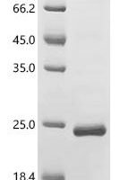 Human papillomavirus 66 Protein E7 (E7) Recombinant Protein - BioCrest Sci