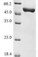 Mouse Nicotinamide phosphoribosyltransferase (Nampt) Recombinant Protein, Tag-Free - BioCrest Sci
