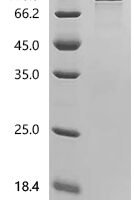 Human ITGAV&ITGB3 Heterodimer Protein Recombinant Protein - BioCrest Sci