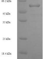 Human Methionine synthase (MTR), partial Recombinant Protein, N-His-SUMO - BioCrest Sci