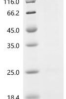 Human Amphiphysin (AMPH) Recombinant Protein - BioCrest Sci