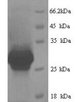 Human Cementoblastoma-derived protein 1 (CEMP1) Recombinant Protein - BioCrest Sci