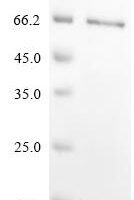 Rat Chondroitin sulfate proteoglycan 4 (Cspg4), partial Recombinant Protein - BioCrest Sci
