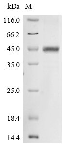 Human Norrin (Ndp) Recombinant Protein, Homo sapiens (Human), E.coli, N-terminal 10xHis-GST-tagged and C-terminal Myc-tagged, 47.6 kDa, purity >≥ 85% as determined by SDS-PAGE.